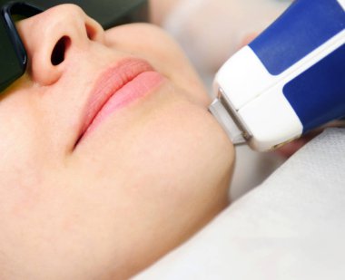 Lazer ve ultrason yüz tedavi tıbbi spa merkezi, cilt gençleştirme kavramı getting kadın