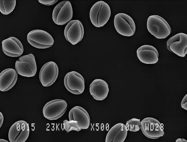 Elektron mikroskobu altında daha az celandine polen