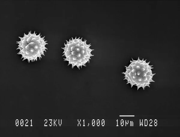 Daisy pollen under electron microscope — Stock Photo, Image