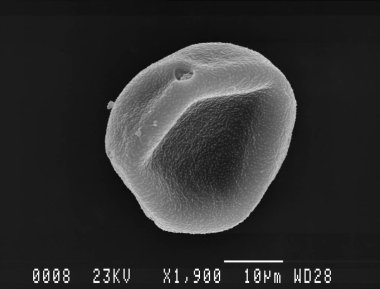 One hornbeam pollen grain scanning electron micrograph