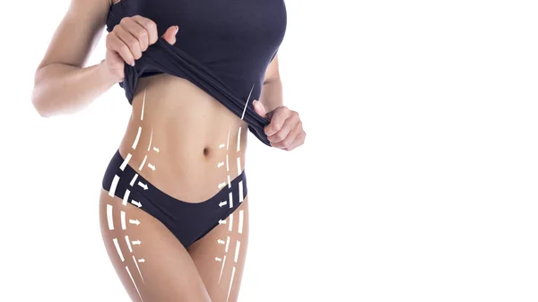 Conceito de lipoaspiração, remoção de gordura e celulite, corpo feminino com excesso de peso com linhas e setas pintadas, isolado em fundo branco . — Fotografia de Stock