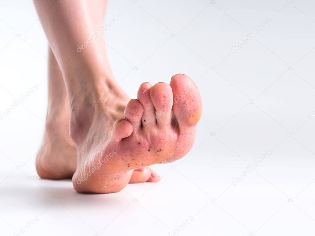 close up view of a dirty human foot on a grey background