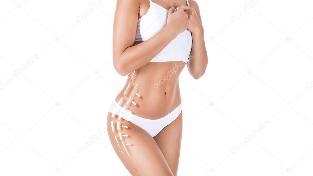 Female body with patterned lines and arrows on it, isolated on white. The concept of plastic surgery, fat removal, liposuction and cellulite