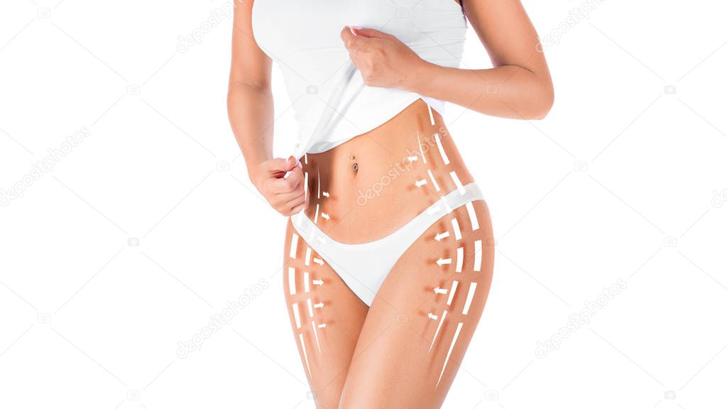 Female body with patterned lines and arrows on it, isolated on white. The concept of plastic surgery, fat removal, liposuction and cellulite