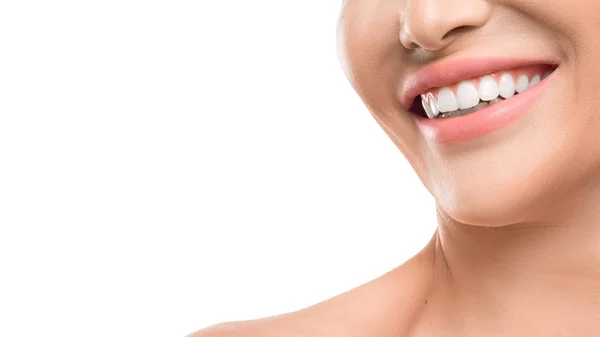 Closse up view of a female smile. Dental concept — Stock Photo, Image