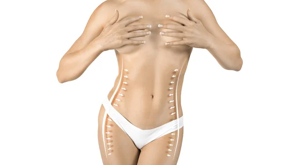 Vista de perto de um corpo feminino com linhas e setas. Remoção de gordura e conceito de lipoaspiração . — Fotografia de Stock