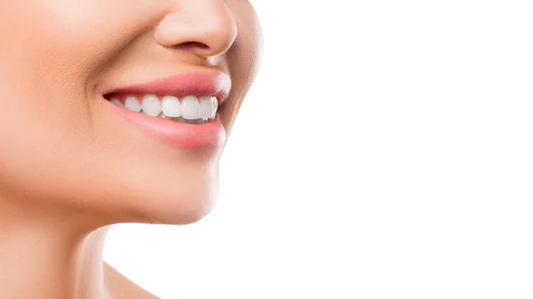 Close up photo of a woman smiling. Teeth whitening and health concept — Stock Photo, Image