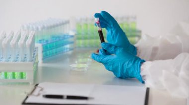 Laboratuvardaki doktor üzerinde enfekte kan örneği olan bir test tüpü tutuyor. Yakın çekim görünümü.