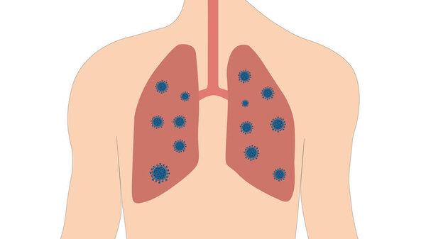 Вирус у человека в дыхательной системе и легких

