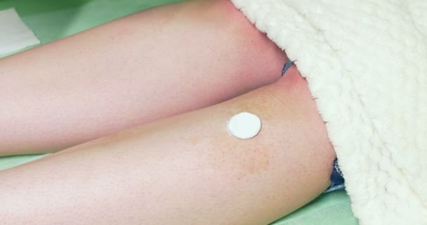 Le médecin applique de la crème après la procédure de beauté. Épilation laser et cosmétologie. Clinique de spa cosmétique — Video