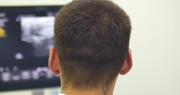 Un medico utilizza un ecografia moderna per visualizzare vena nella procedura di scleroterapia. Un metodo innovativo di chirurgia delle vene varicose, primo piano — Video Stock