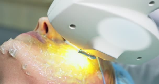 Der Arzt Trägt Gel Auf Das Schönheitsverfahren Auf Laserepilation Und — Stockvideo