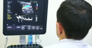 Erkek doktor bir ultrason tanı yapmak. Karın için ultrason aygıt ekranına bakarak hastane