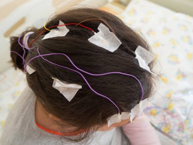 Kız kafasını tıbbi test için bağlı Eeg elektrotlar ile