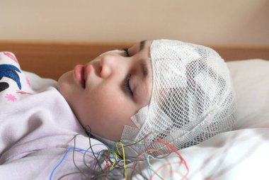 Girl with EEG electrodes attached to her head for medical test clipart
