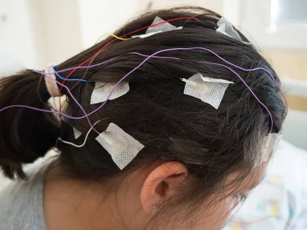 Menina com eletrodos EEG ligados à cabeça para teste médico — Fotografia de Stock