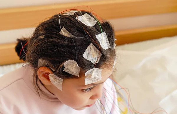 Menina com eletrodos EEG ligados à cabeça para teste médico — Fotografia de Stock