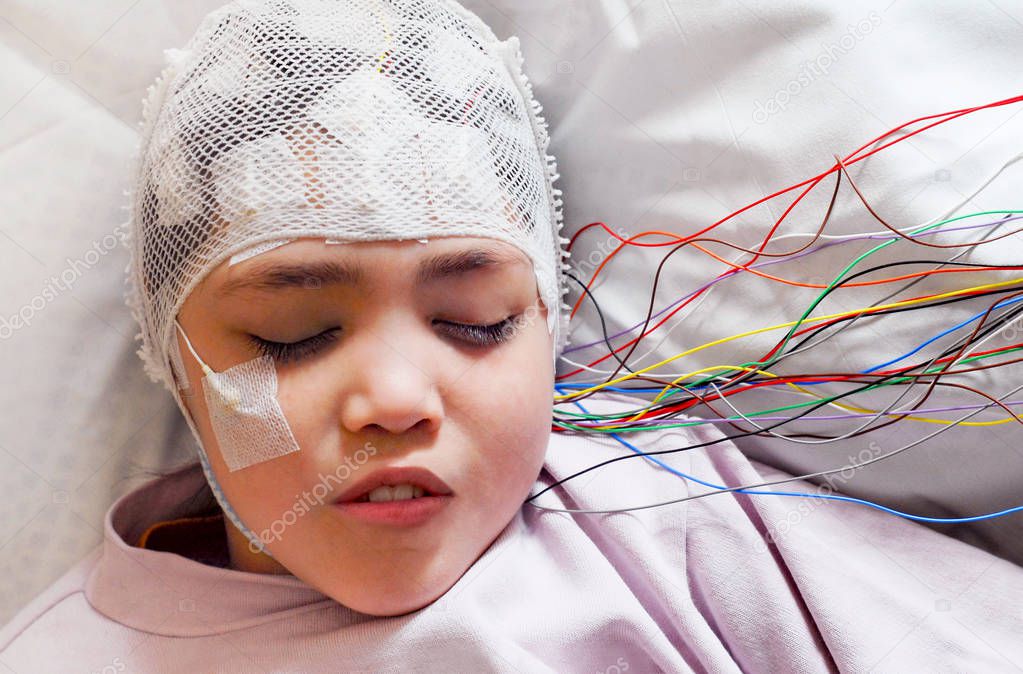 Girl with EEG electrodes attached to her head for medical test