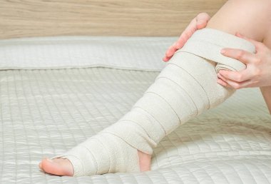 Elastik sıkıştırma bandaj varisli ameliyattan sonra uygulama kadın