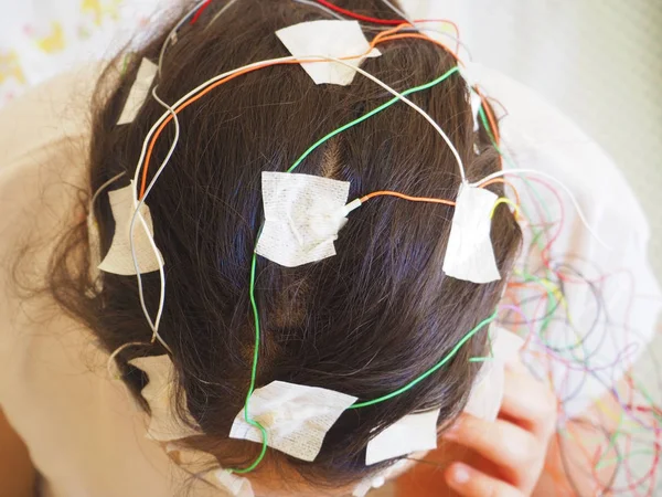 Kız kafasını tıbbi test için bağlı Eeg elektrotlar ile — Stok fotoğraf