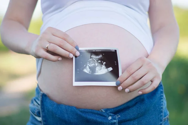 庭で若い美しい妊娠中の女の子は 超音波の画像を保持します — ストック写真