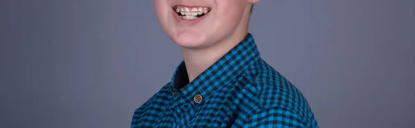 Portret Nastolatkiem Płyty Jego Zęby Niebieską Koszulę Studio Szary Tło — Zdjęcie stockowe