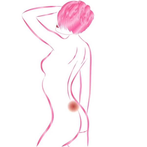 Dolor de espalda ilustración vector corporal femenino — Vector de stock