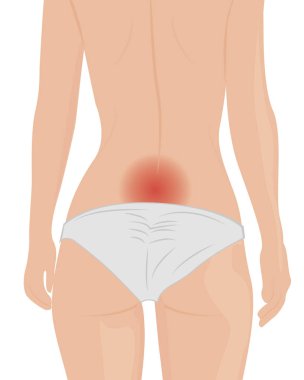 Ağrı kadın bedeni vektör çizim geri