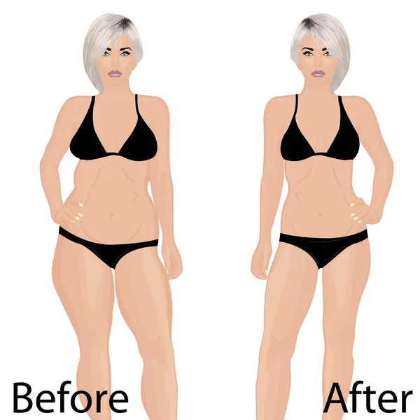 Kadın vücut düzeltme. Liposuction. Önce ve sonra. vektör çizim — Stok Vektör