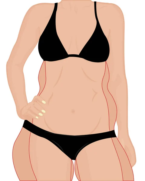 Correction femme figure. Sois mince. Illustration vectorielle de liposuccion — Image vectorielle