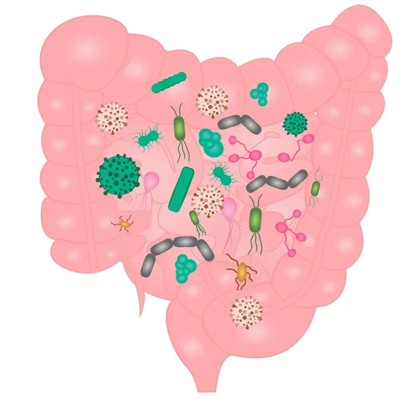 İnce bağırsak içinde bakteriyel büyüme durdurmak — Stok Vektör