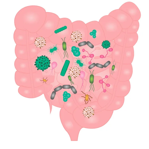 Bacteriële overgroei in de dunne darm te stoppen — Stockvector