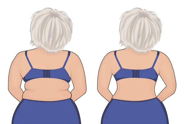 Fata grasă şi subţire s-a întors. Hoţ de grăsimi. Liposucţie. Înainte şi după. Femeie corp corecție vector ilustrare — Vector de stoc