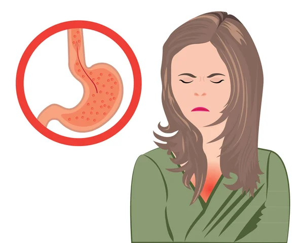 Gastroesofageal refluxsjukdom. Gerd mage i en mänsklig kropp vektor illustration — Stock vektor