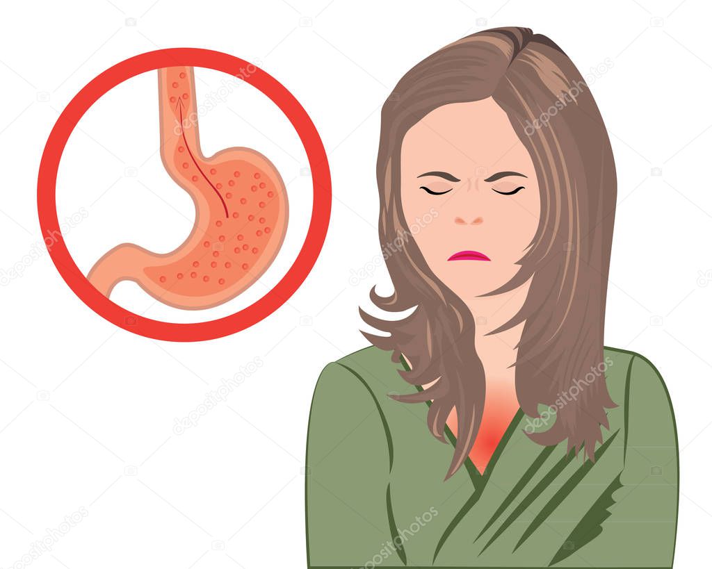 Gastroesophageal reflux disease. Gerd stomach in a human body vector illustration