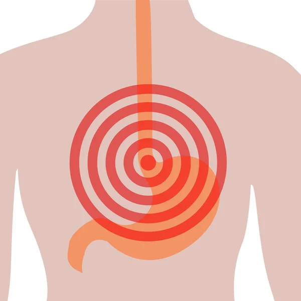 Dolor de estómago en el cuerpo humano. Dolor abdominal. Ardor de estómago. Descodificador del sistema digestivo — Vector de stock