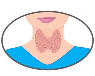 goiter, thyroid, dysfunction, endocrine, disorder, enlarged thyroid, hyperthyroidism, disbalance