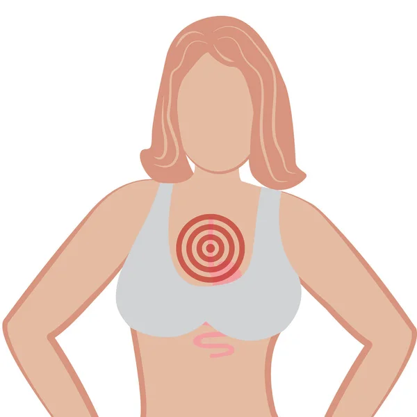 Reflux gastro-œsophagien. Gerd estomac dans un corps humain vecteur illustration — Image vectorielle