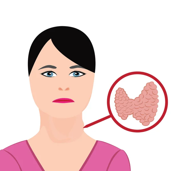 Malattia tiroidea. Illustrazione del vettore della disfunzione endocrina — Vettoriale Stock