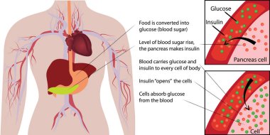 Kan şekeri glukoz emilimini bir insan vücudu infographics içinde