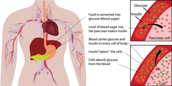 Kan şekeri glukoz emilimini bir insan vücudu infographics içinde — Stok Vektör