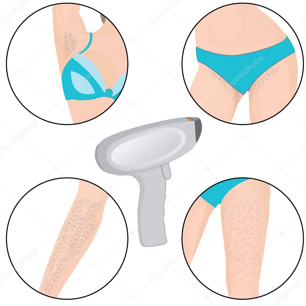 Hair removal zones  laser removal on a girl body vector illustration