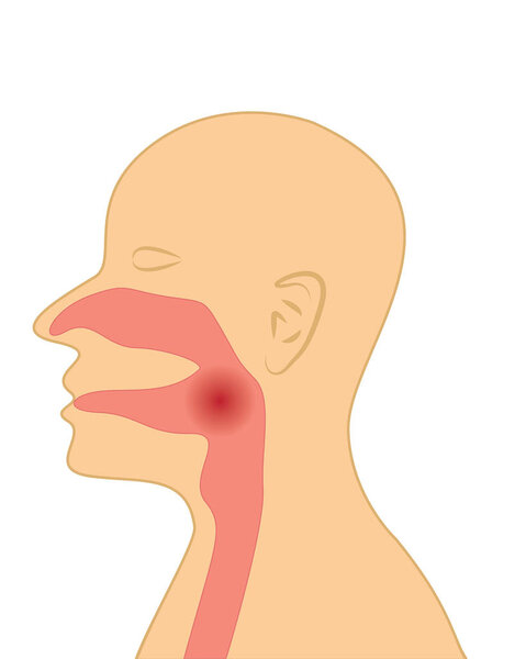 Боль в горле человека
