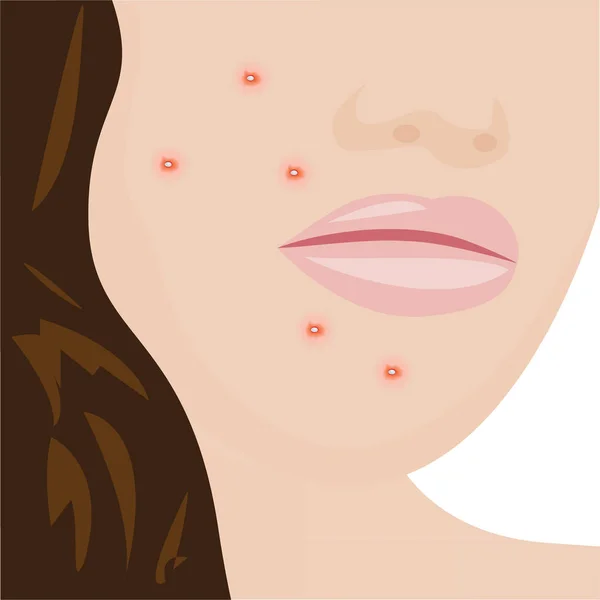 Uma jovem mulher tendo acne —  Vetores de Stock