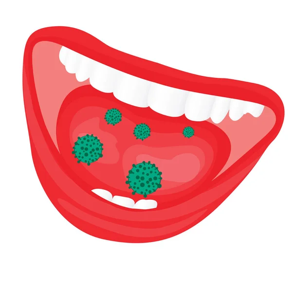 Vírus crescimento excessivo bacteriano em uma boca . — Vetor de Stock