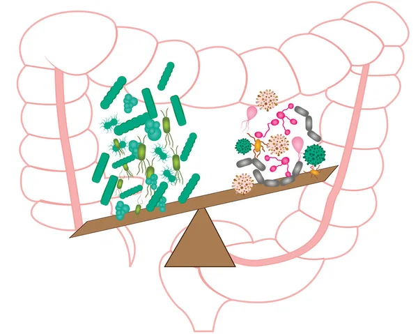 Bactérias Intestinais Flora Bactérias Boas Más Ilustração Vetorial — Vetor de Stock