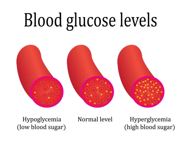 Κανονισμοί Επίπεδο Σακχάρου Του Αίματος Έλεγχος Ιατρική Εργαστηριακή Ανάλυση Διανυσματική — Διανυσματικό Αρχείο