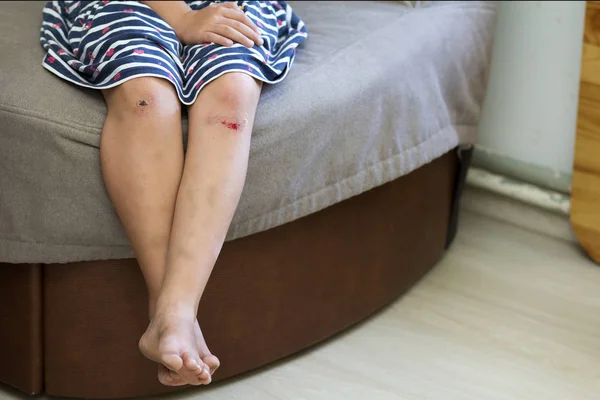 Primer Plano Niña Descalza Piernas Con Lesiones Las Rodillas Dañadas —  Fotos de Stock