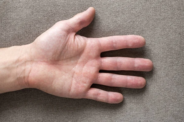 Close-up of male masculine hand with rough skin and short fingernails resting on flat copy space background, top view. Manual labor and hands care concept.