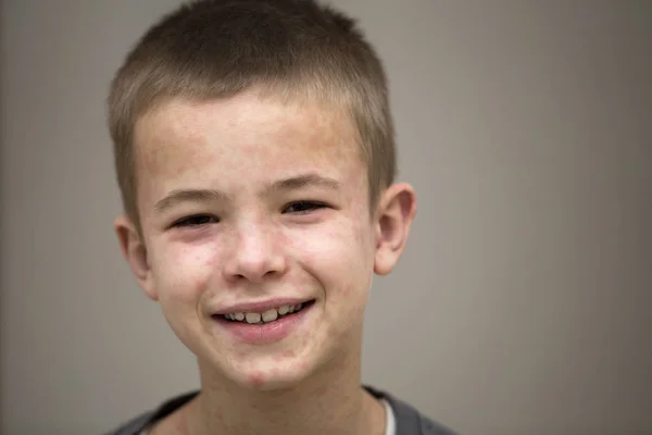 Portrait of sick smiling boy child suffering from measles or chi — Stock Photo, Image